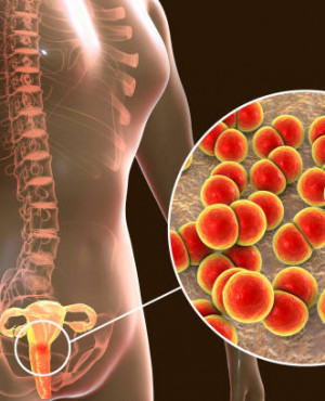 Gonorrhoea Test