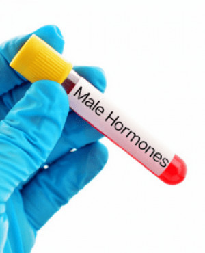 Male Hormone Profile