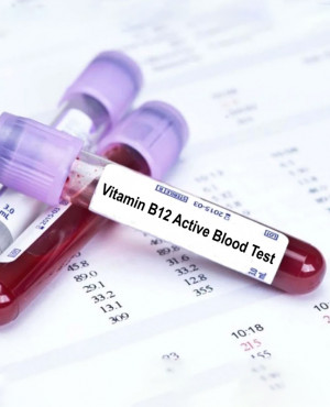 Vitamin B12