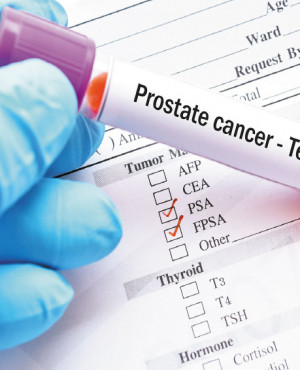 Prostate Cancer