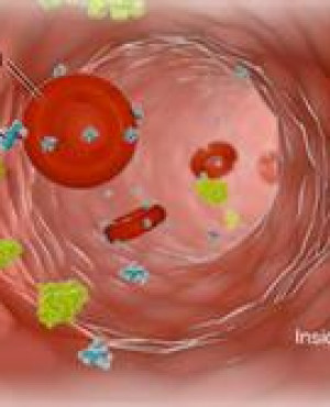 Metabolic syndrome profile