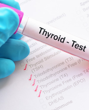 Thyroid Profile - Advanced