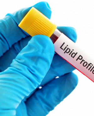 Lipid Function Test