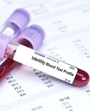 Infertility profile