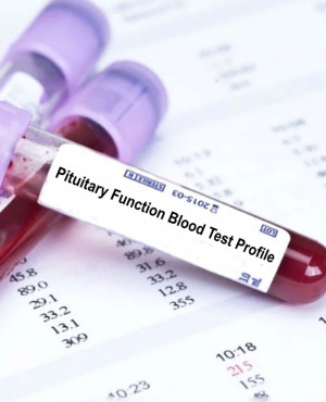 Pituitary function profile