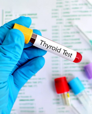 Thyroid Profile – Basic